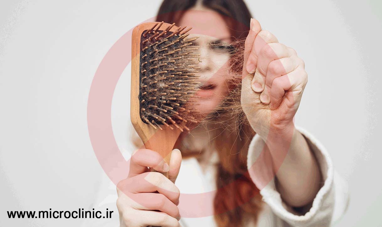 درمان ریزش مو با دو روش PRGF و PRP